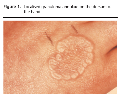 George Part 2, Figure 1