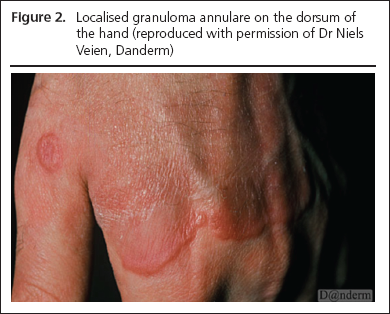 George Part 2, Figure 2