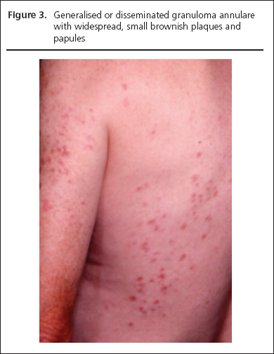 George Part 2, Figure 3