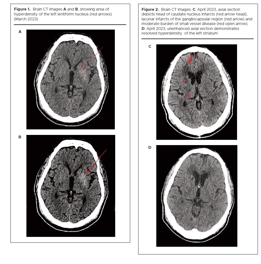 1307 Figures 1 and 2