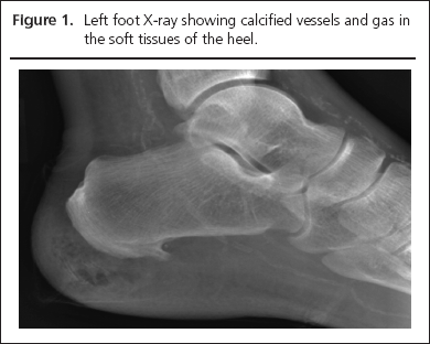 15-0051-Herring-aop-figure1