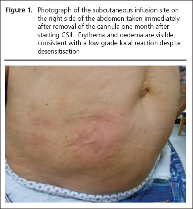 34-35-gregory-figure1