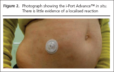 34-35-gregory-figure2