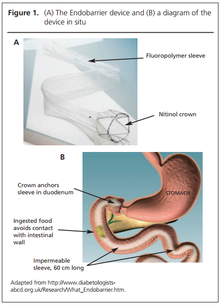 201801 Ryder Figure 1
