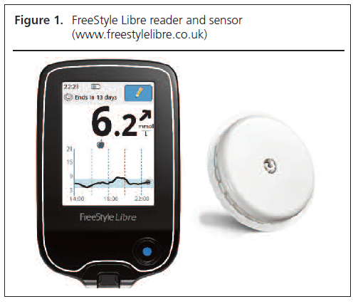 2018 03 Wilmot Figure 1