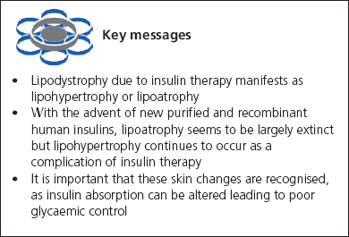 Key messages