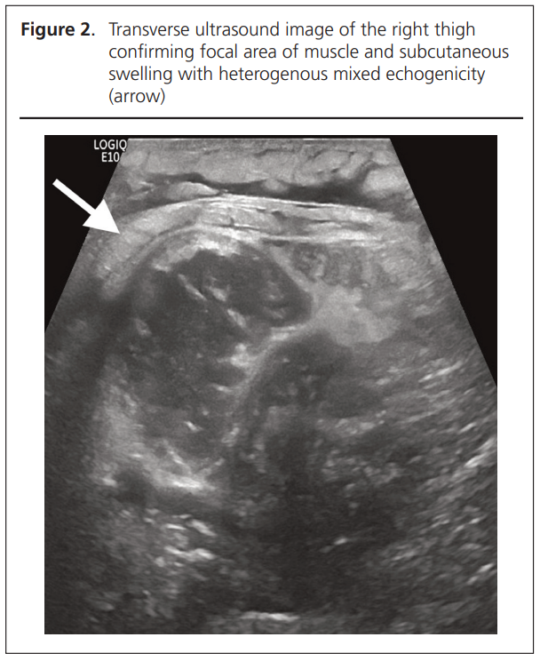 779 Koysombat Figure 2