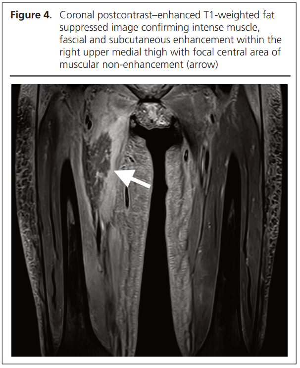 779 Koysombat Figure 4