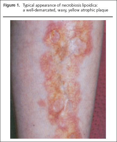 George Part 1, Figure 1