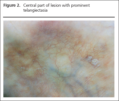 George Part 1, Firgure 2