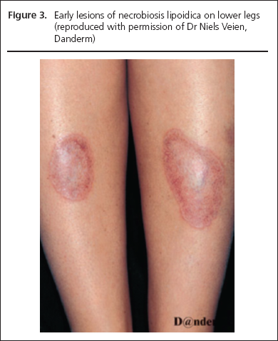 George Part 1, Figure 3