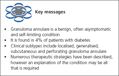 George Part 2, Key messages