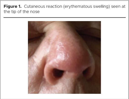 1119 Bukhari Figure 1
