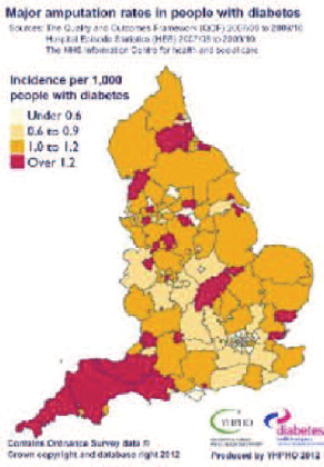 Map of amputation rates