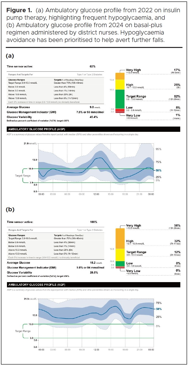 1395 Golding Figure 1