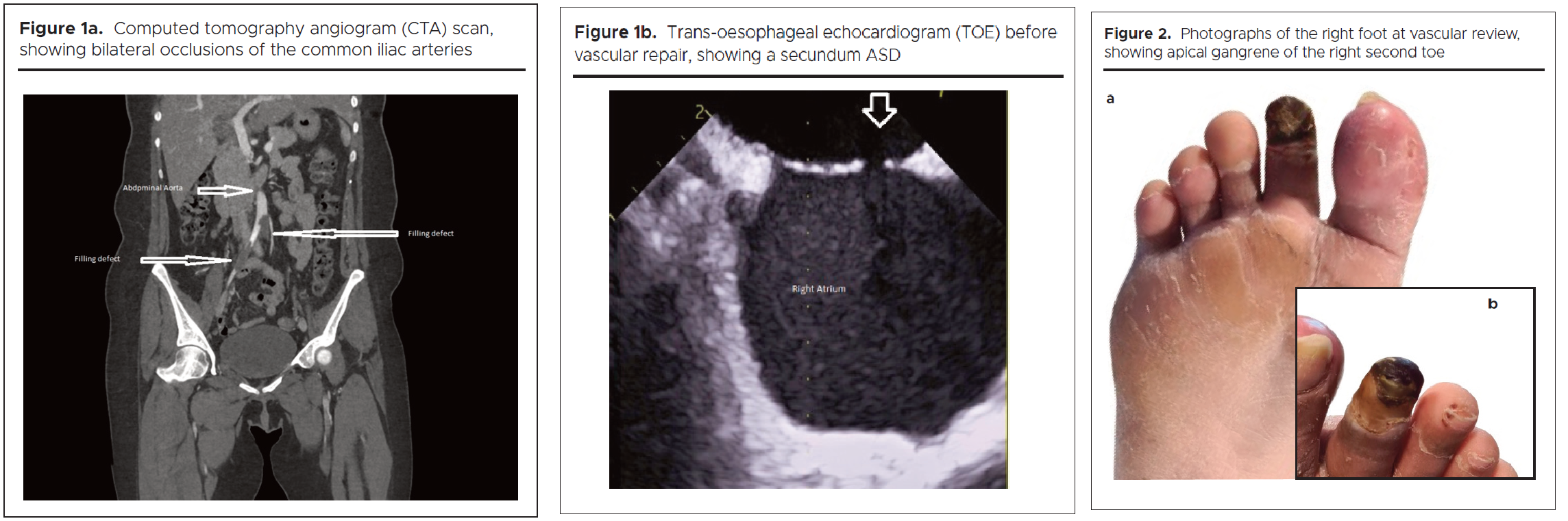1455-figures-1a-1b-2