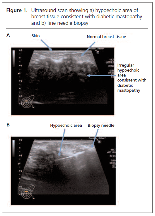 2018 03 Shrikrishnapalasuriyar Figure 1