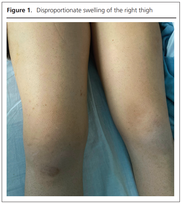 779 Koysombat Figure 1