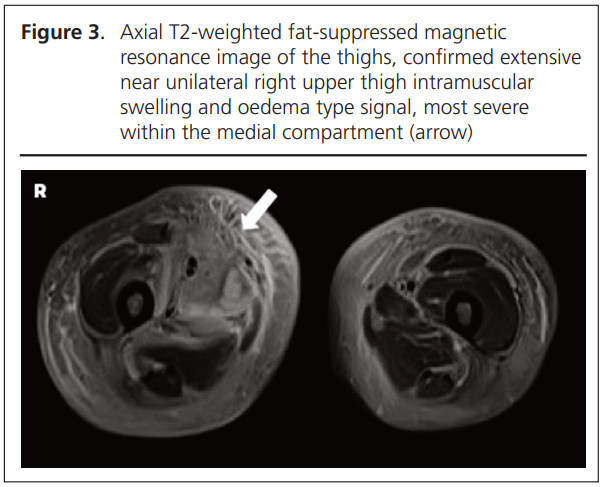 779 Koysombat Figure 3